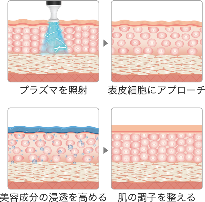 プラスマを照射→表皮細胞にアプローチ→美容成分の浸透を高める→肌の調子を整える