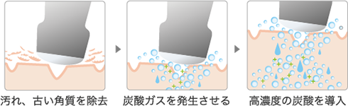 汚れ、古い角質を除去→炭酸ガスを発生させる→高濃度の炭酸を導入