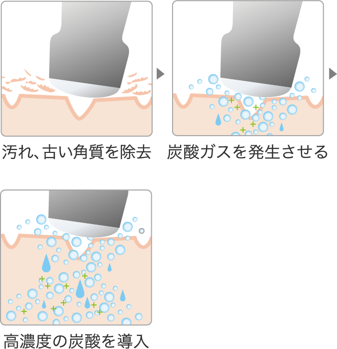 汚れ、古い角質を除去→炭酸ガスを発生させる→高濃度の炭酸を導入