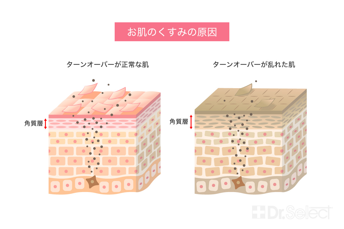 お肌のくすみの原因