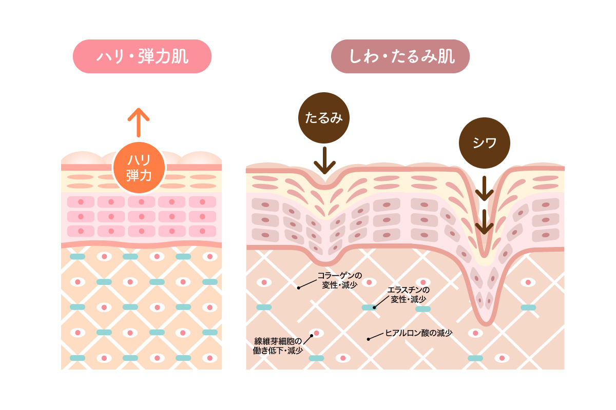 ハリ・弾力のある肌とシワ・たるみのある肌