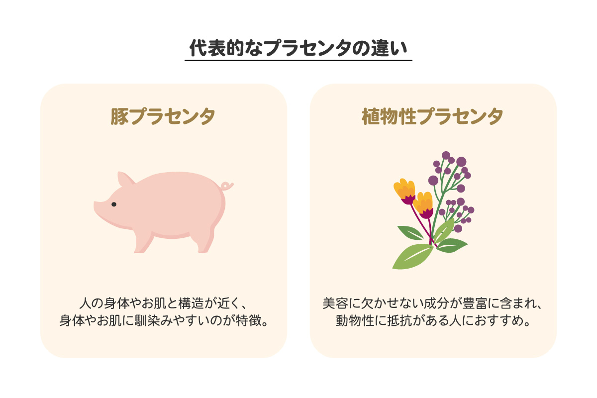 代表的なプラセンタの違い