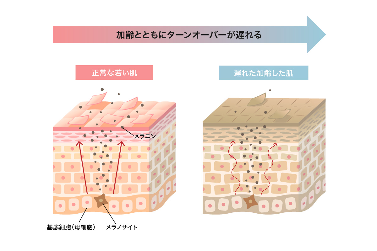 加齢とともに遅れるターンオーバー